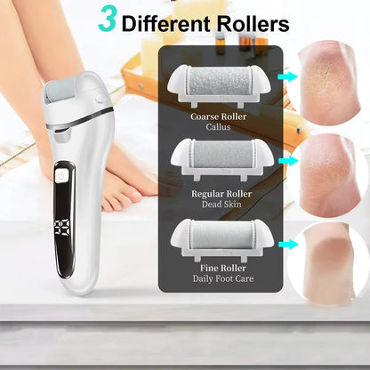 Gizmoteria™ Electric Callus Removal
